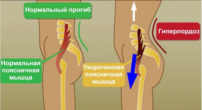 eteenpäin split: PSOAS