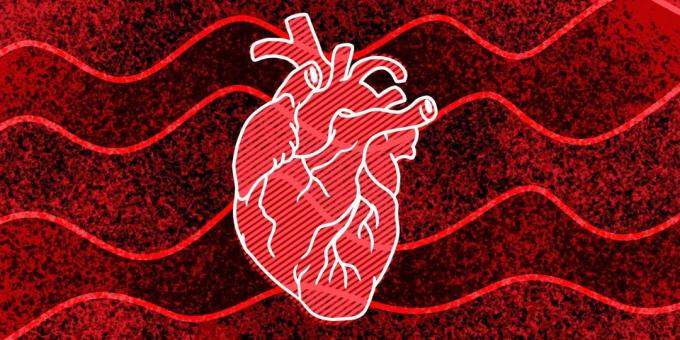 11 merkkejä siitä, että te voi tapahtua sydänpysähdyksen