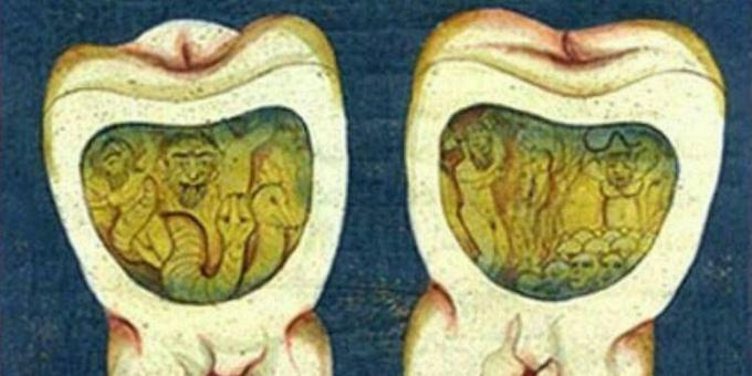 Keskiaikainen lääketiede: Sivu ottomaanien hammaslääketieteestä, 1700 -luku.