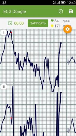 EKG